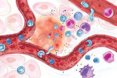 Efeito da Boswellia em áreas inflamadas do corpo